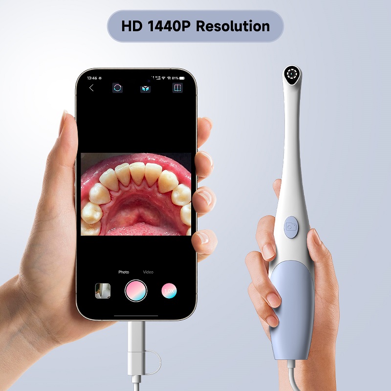 口腔内視鏡カメラ 1440P 写真&ビデオハンドヘルドビジュ - Photography Lighting Handheld のレビューと価格