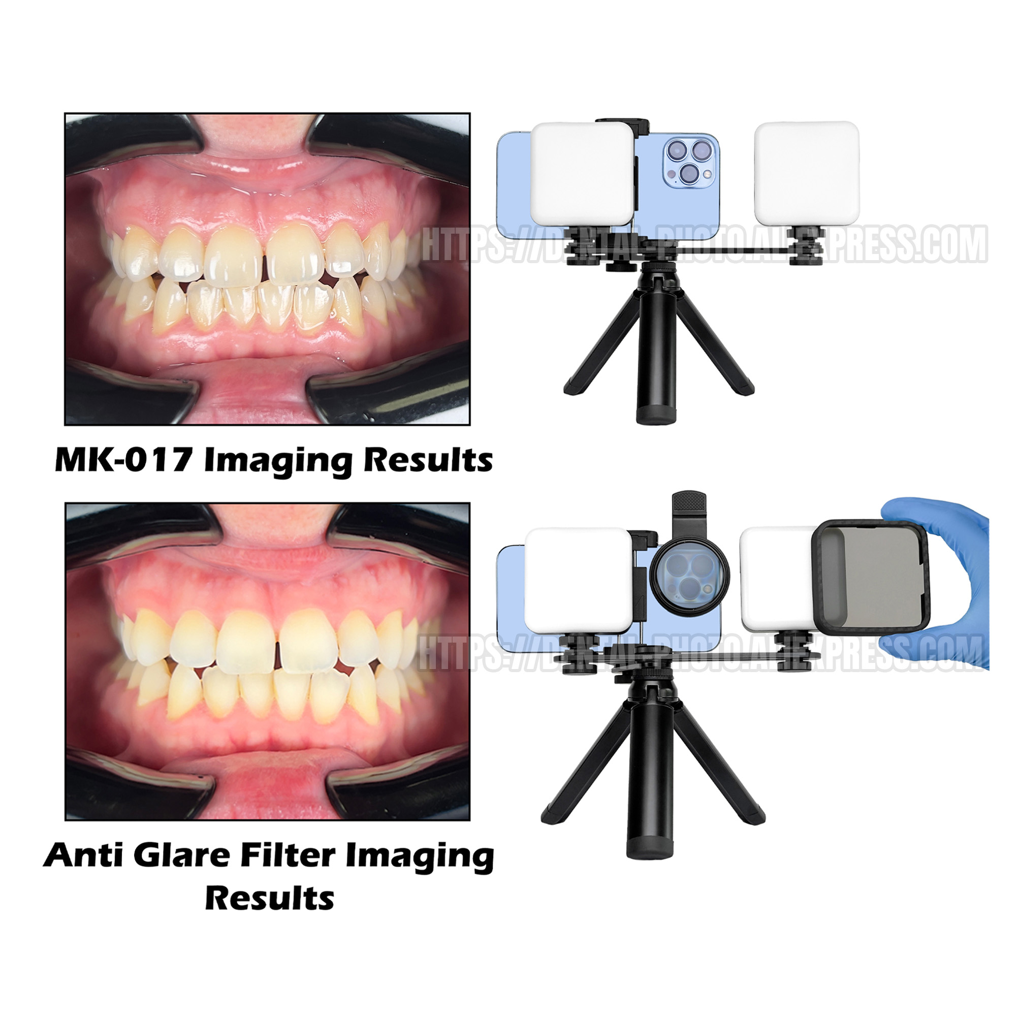 HERA 携帯電話写真撮影用LEDフィルライト 歯科写真、マ - Photography Mobile Lighting のレビューと価格